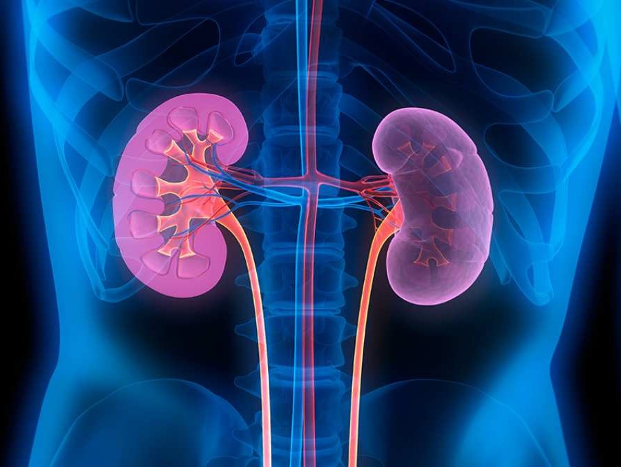 diet tinggi protein dan kesehatan ginjal pada Hari Ginjal Sedunia